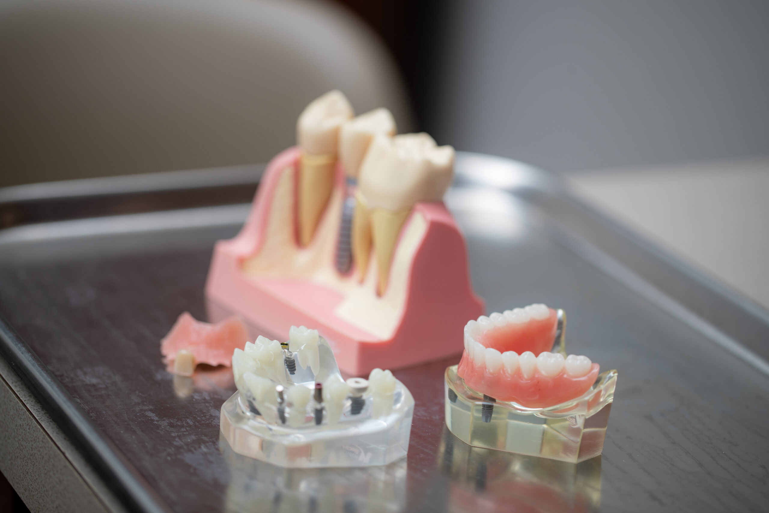 models of dental implants, dentures and tooth replacement options at Associated Oral & Implant Surgeons