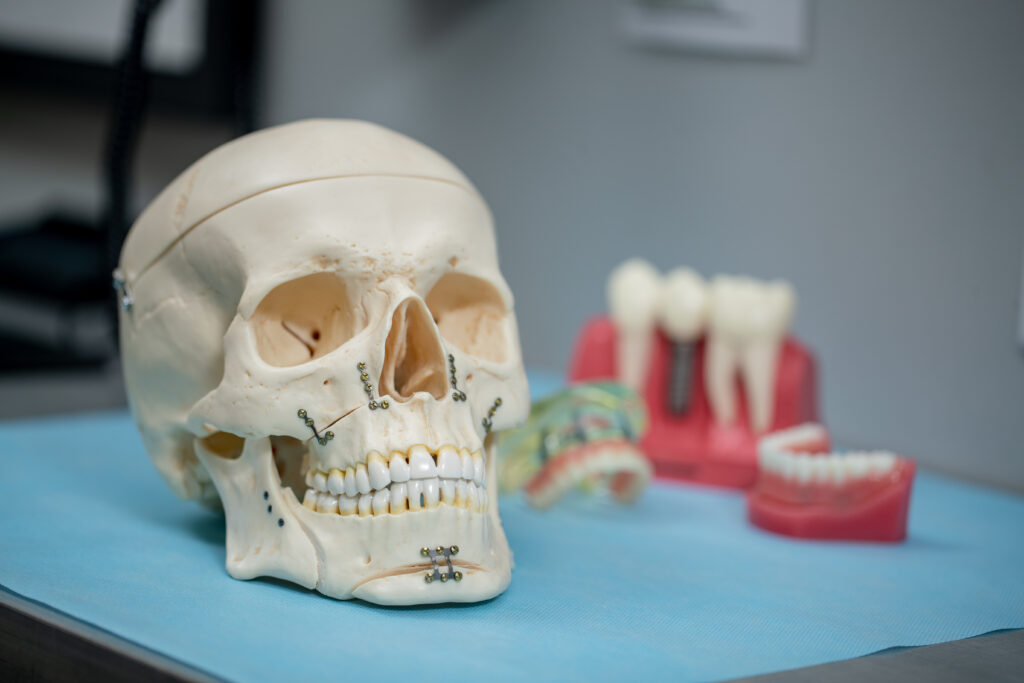 anatomical skull and dental implant and dentures mold used for explaining oral surgery and dental implant procedures at Associated Oral & Implant Surgeons