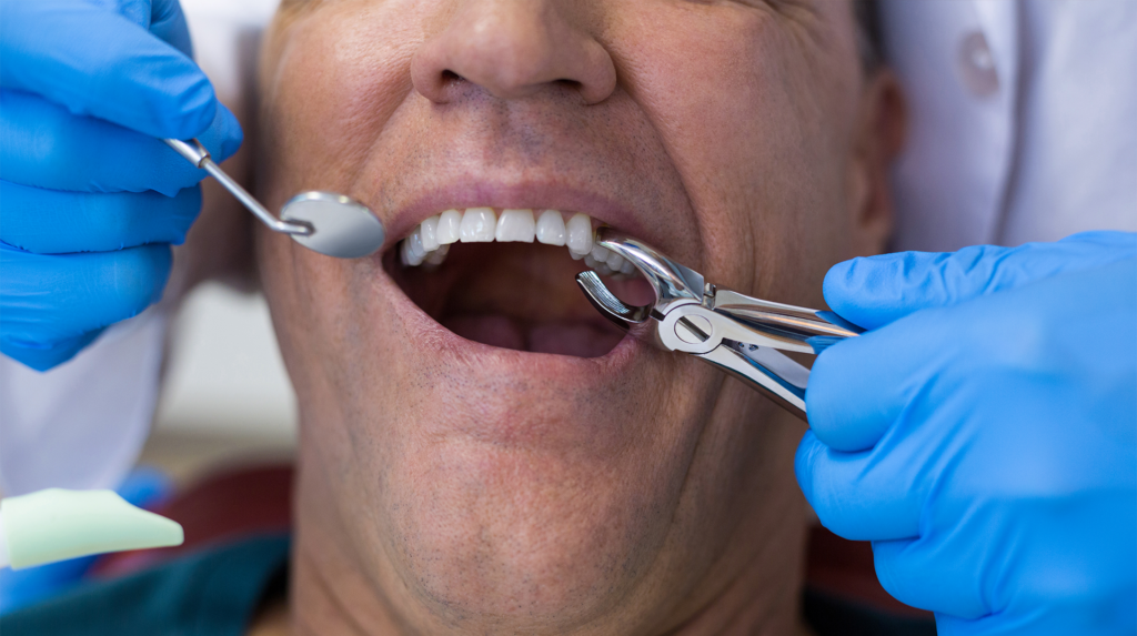 patient about to undergo the removal of multiple teeth at Associated Oral & Implant Surgeons
